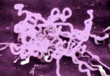 How does syphilis manifest, after how many days do the first symptoms appear?