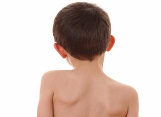 Liečba skoliózy u detí Známky zakrivenia chrbtice u detí